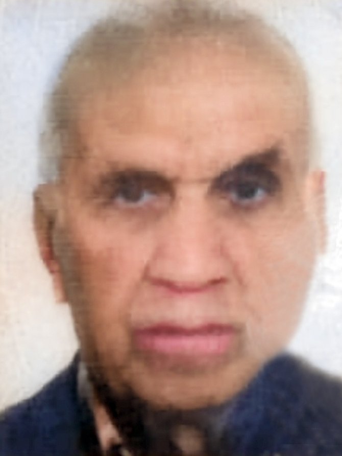 Kazada yaralanan sürücü hayatını kaybetti