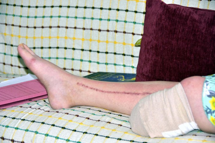 Eşini vurup bacağının kesilmesine neden olan sanık: Böyle bir evlilik hayal etmedim