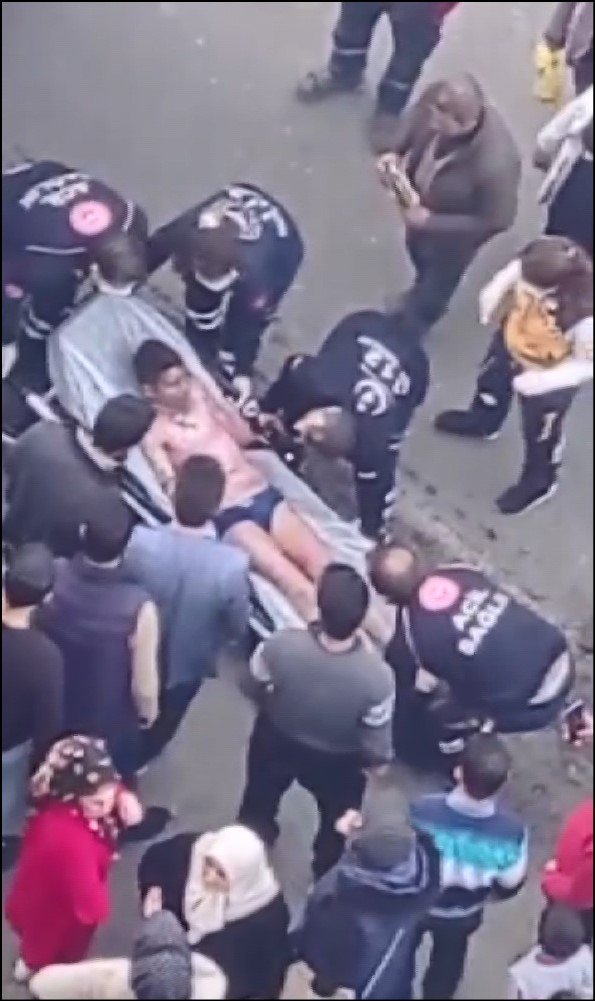 Vücudunun yüzde 40'ı yandı; sağlık durumu kritik