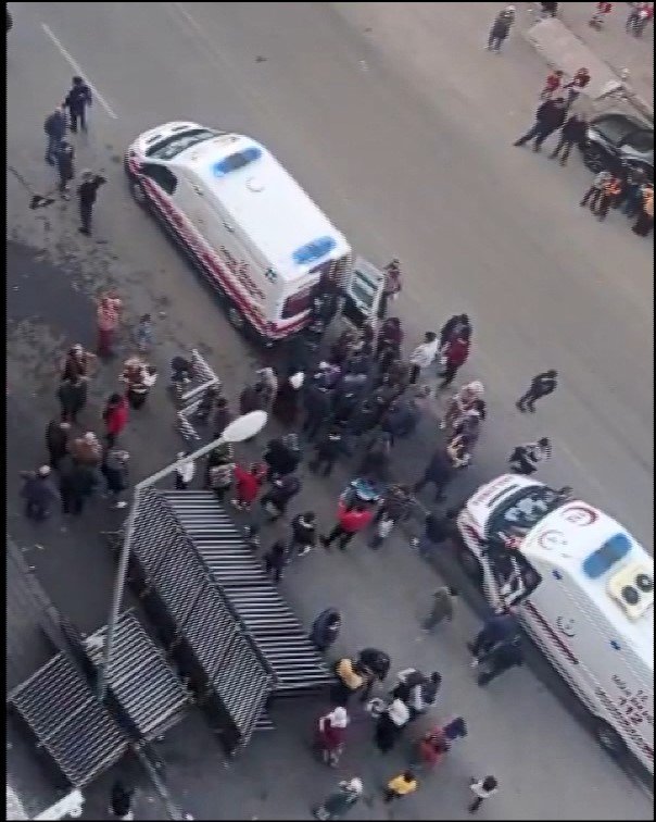 Vücudunun yüzde 40'ı yandı; sağlık durumu kritik