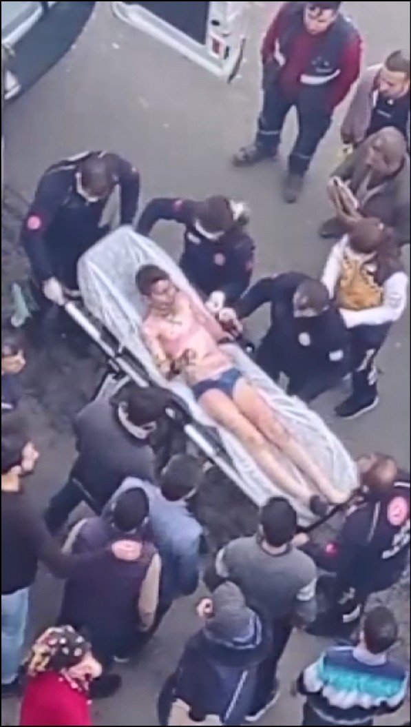 Vücudunun yüzde 40'ı yandı; sağlık durumu kritik