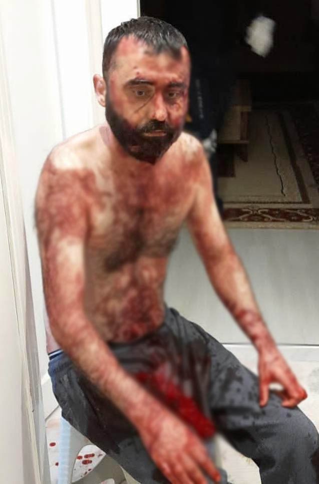 Eski kocadan maket bıçaklı dehşet