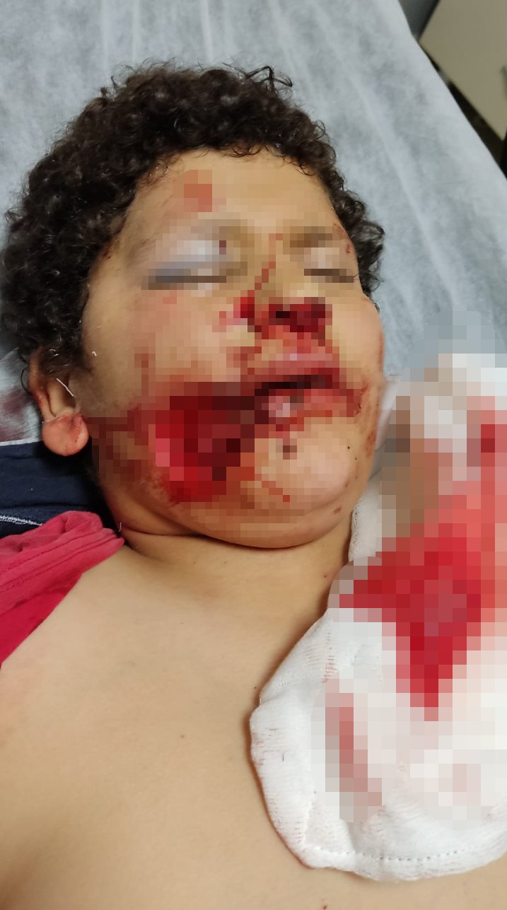 Yüzünden parça kopan Serdar, ambulans uçakla götürüldüğü Antalya'da ameliyat edildi