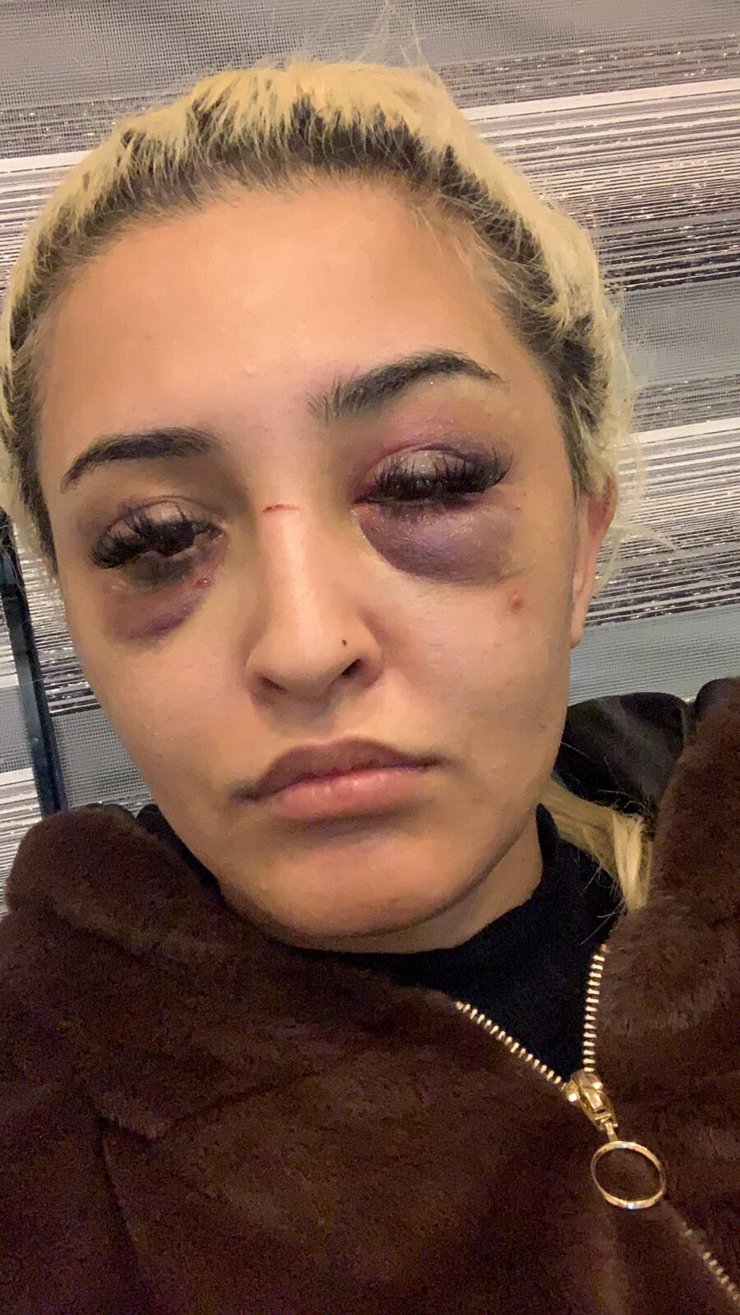 Gamze'nin darpla suçladığı eski sevgilisine cinsel saldırıdan da suç duyurusu