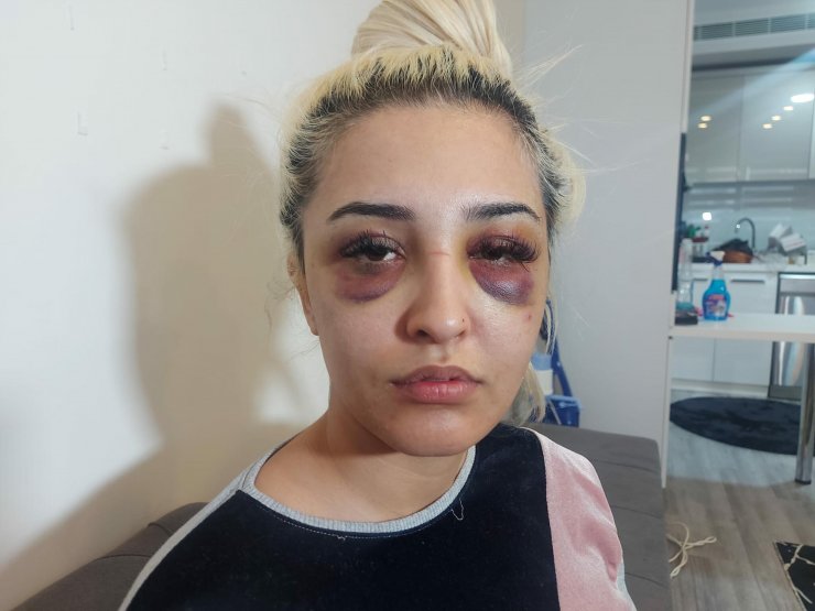 Gamze'nin darpla suçladığı eski sevgilisine cinsel saldırıdan da suç duyurusu