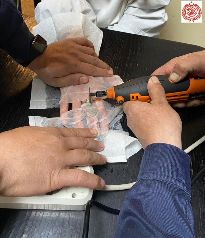 Parmağına sıkışan yüzüğü itfaiye çıkardı.