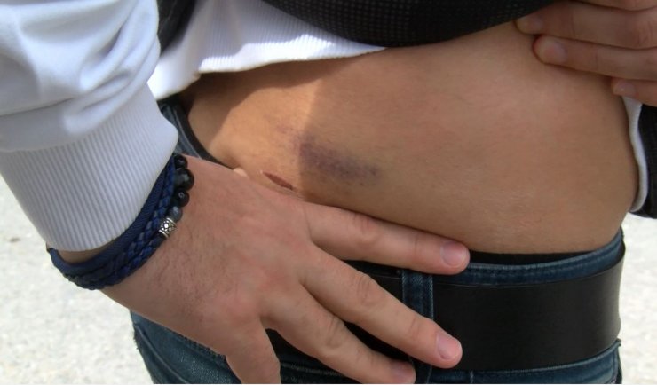 Pitbull saldırısından otomobilin üstüne çıkarak kurtulduğu anları anlattı