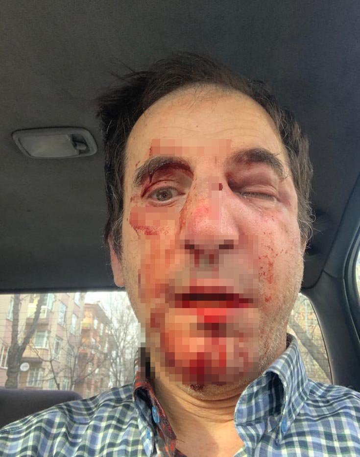 Profesöre 'burun ameliyatı' dayağına 28'er yıla kadar hapis talebi