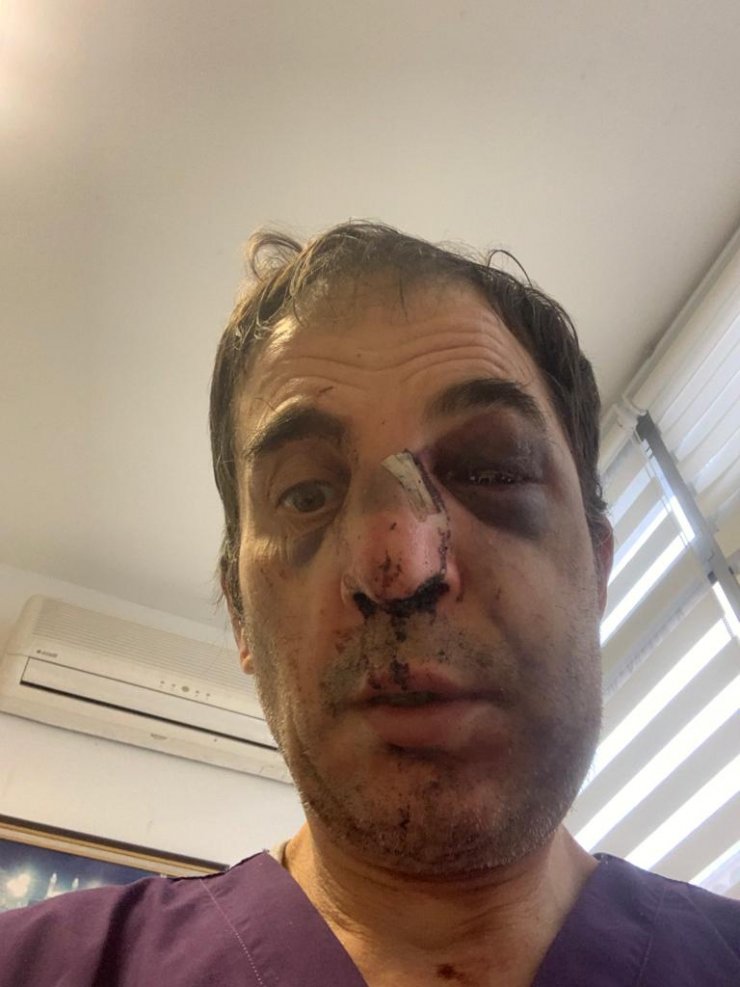 Profesöre 'burun ameliyatı' dayağına 28'er yıla kadar hapis talebi