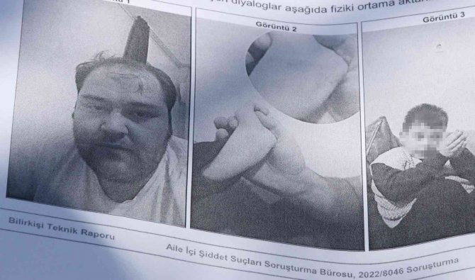 Anne şiddeti iddiasıyla 5 yaşındaki çocuğunun velayetini istiyor