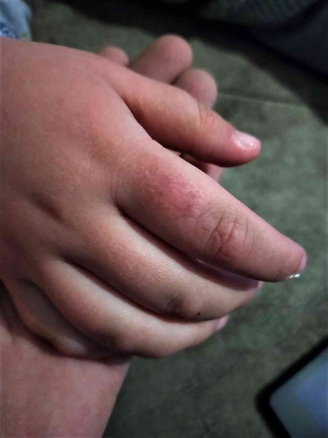 Anne şiddeti iddiasıyla 5 yaşındaki çocuğunun velayetini istiyor