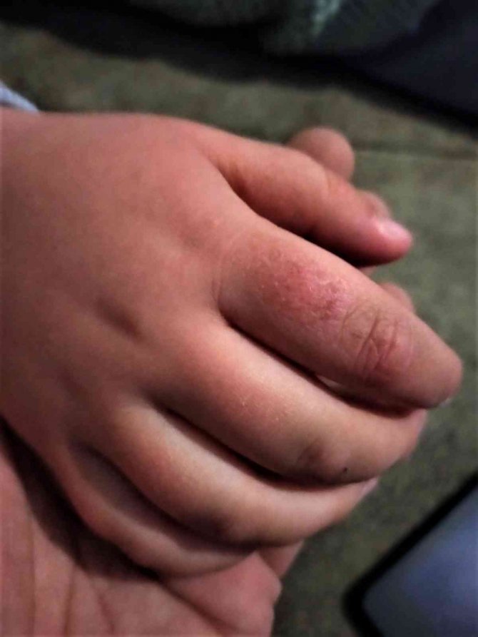 Anne şiddeti iddiasıyla 5 yaşındaki çocuğunun velayetini istiyor