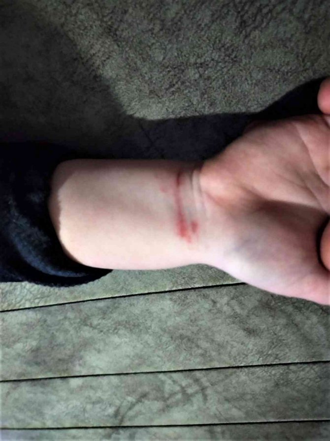 Anne şiddeti iddiasıyla 5 yaşındaki çocuğunun velayetini istiyor