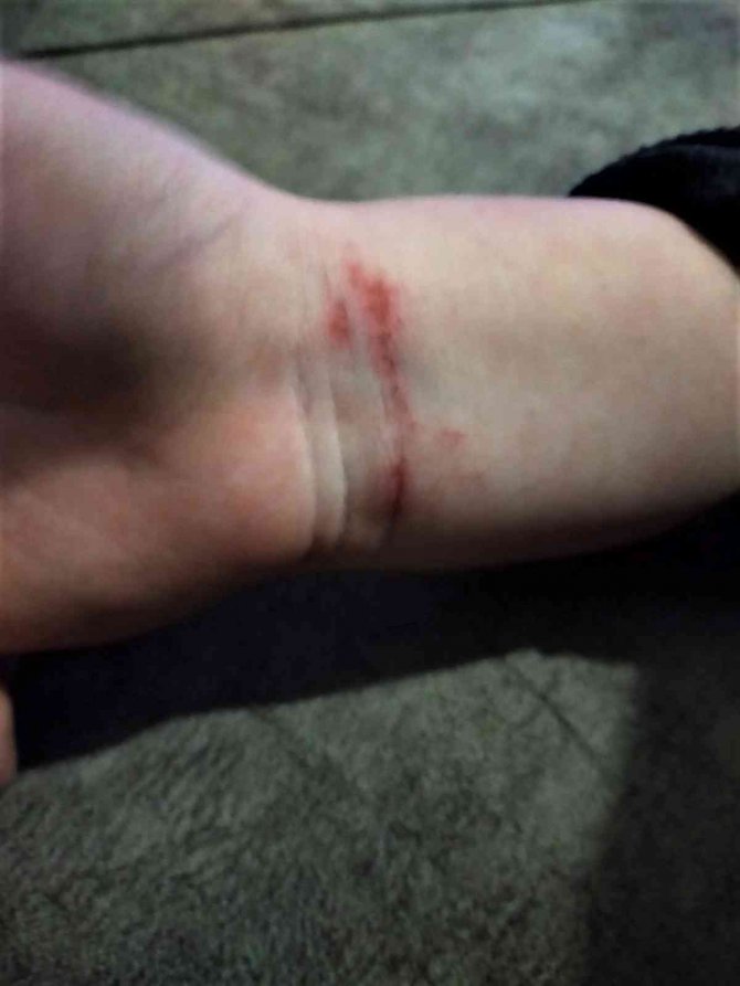 Anne şiddeti iddiasıyla 5 yaşındaki çocuğunun velayetini istiyor