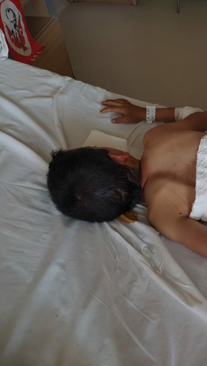 8 yaşındaki çocuğa köpek saldırdı