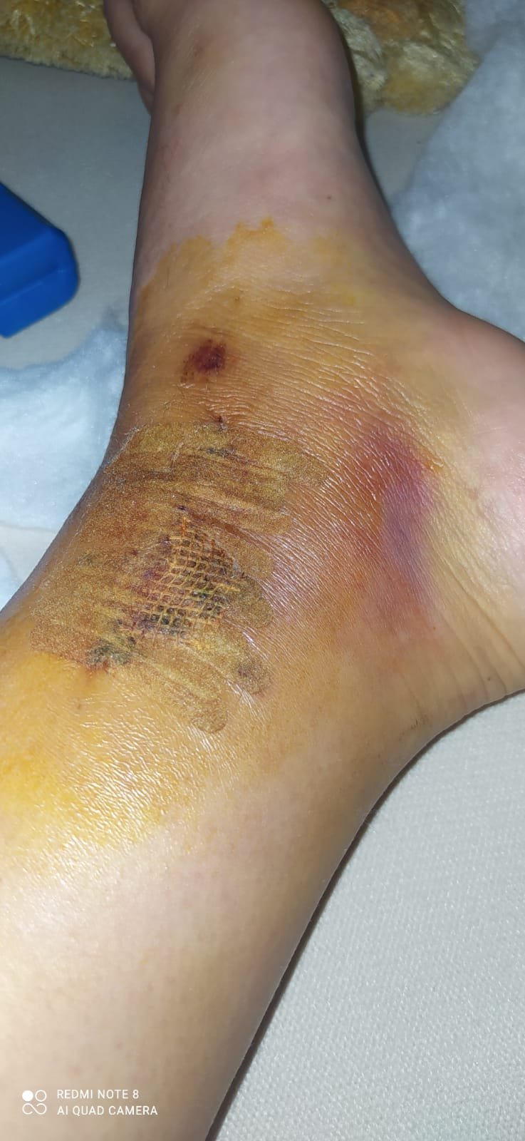 Trafikte tartıştığı 3 kişiyi aracıyla çarparak yaraladı