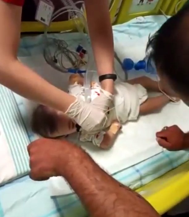 Devrilen ambulansta yaralanan SMA'lı Elif bebek, taburcu oldu