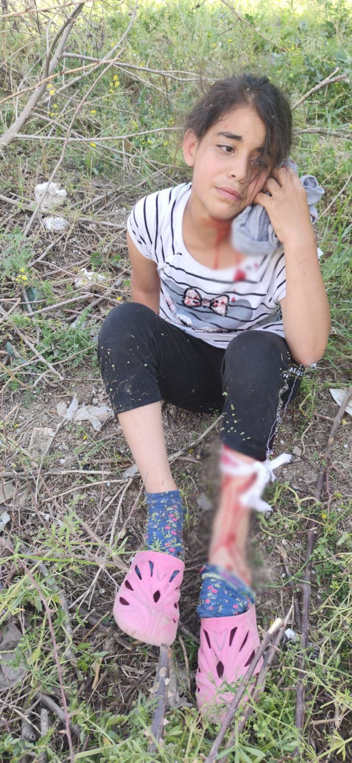 Sokak köpeklerinin saldırdığı çocuk yaralandı