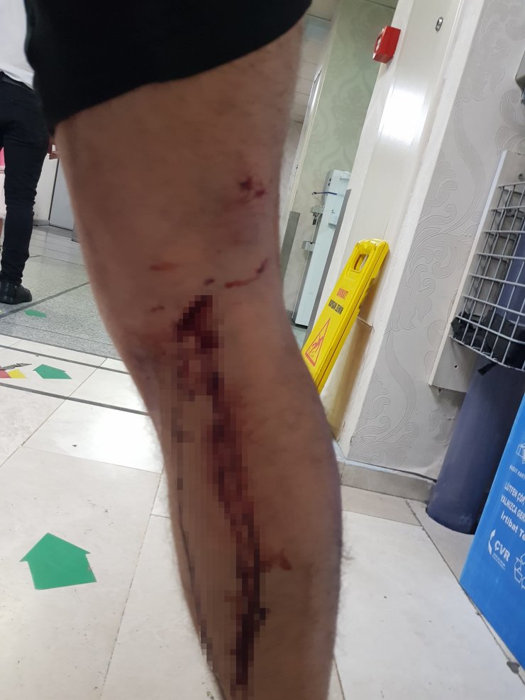 Köpeklerin saldırısında yaralandı