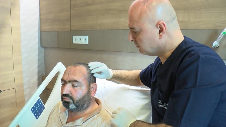 İş yerinde başına halat zincir çarpan işçi, ölüm riskine rağmen hayata tutundu