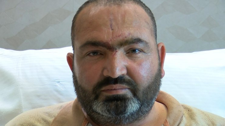 İş yerinde başına halat zincir çarpan işçi, ölüm riskine rağmen hayata tutundu