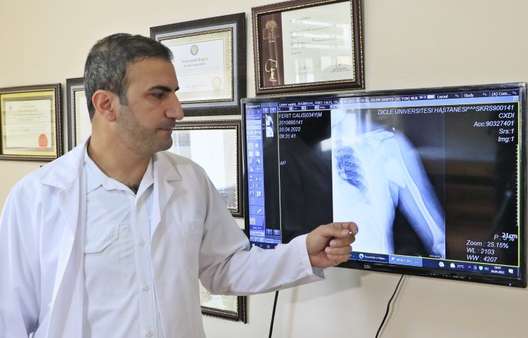 Bacağından alınan kemikle, kolu kesilmekten kurtuldu