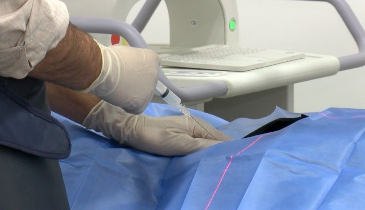 Fıtıkta ameliyatsız tedavi dönemi; yüzde 90 olumlu sonuç alınıyor