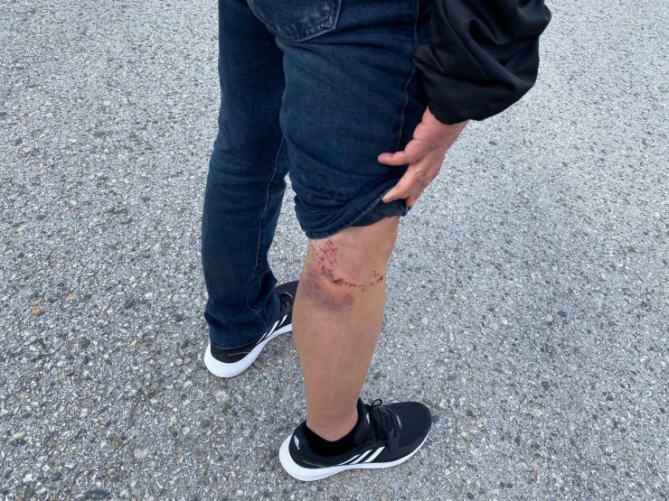 Köpeklerin saldırdığı liseliyi güvenlik görevlisi kurtardı