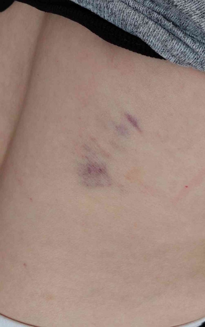 Anneler gününde kayınvalideye öldüresiye dayak