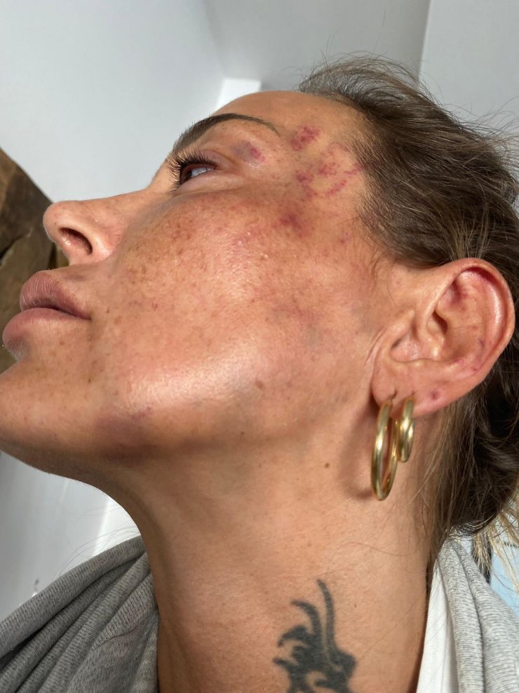 Dayakçı eski sevgiliye 16 yıl hapis istendi