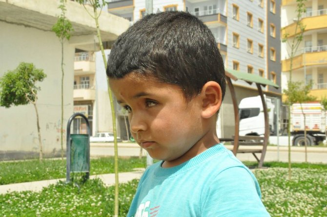 Savaş mağduru çocuğa tümör darbesi