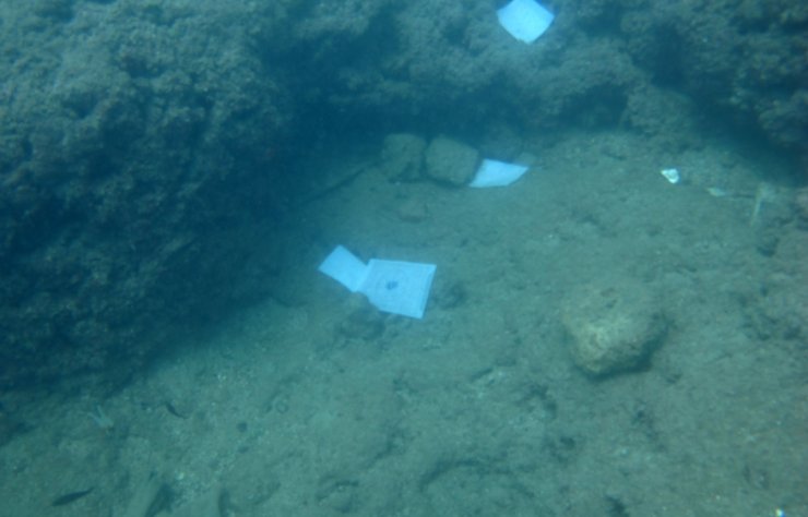 Böyle dilek görülmedi; dudağa dolgu, Bodrum'da yazlık ev