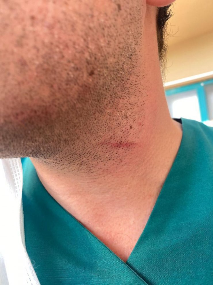 Hasta yakını, 'adli vaka' girişi yapan doktoru darbetti