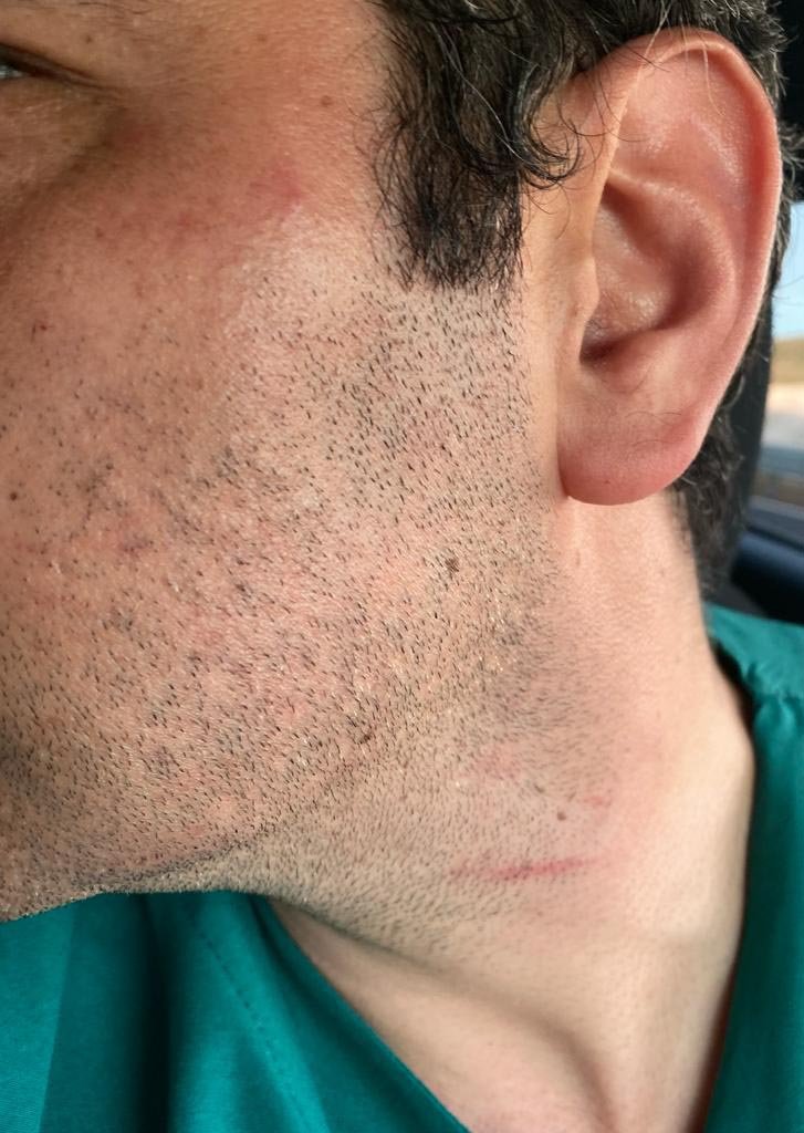 Hasta yakını, 'adli vaka' girişi yapan doktoru darbetti