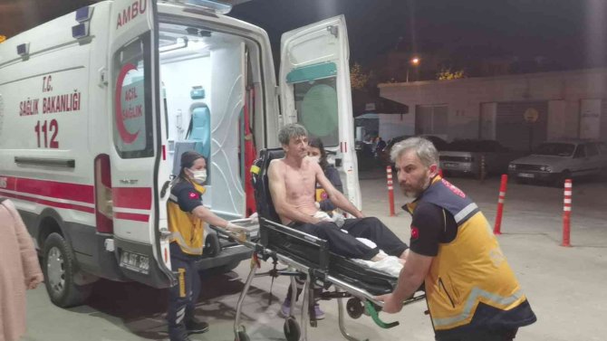 Üzerine asit dökülen işçi ağır yaralandı