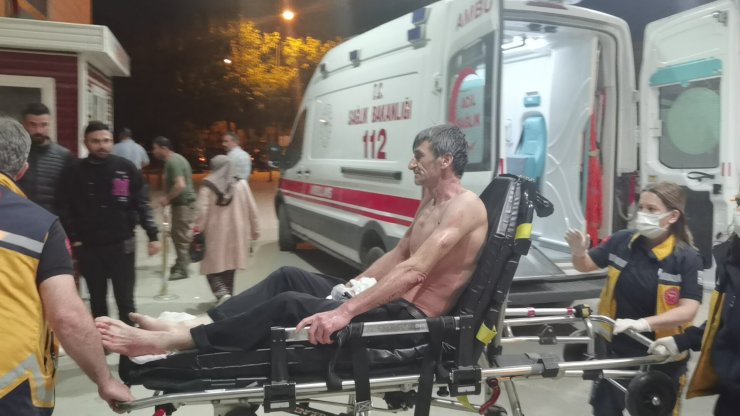 Üzerine asit dökülen işçi ağır yaralandı