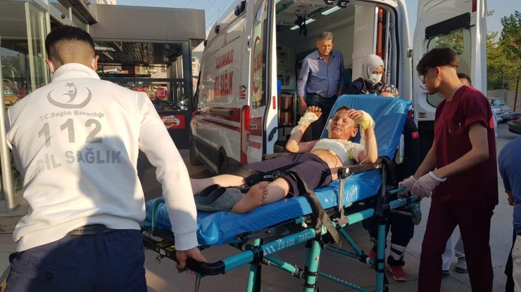 Benzin bidonunu çakmakla yakınca vücudu yandı 