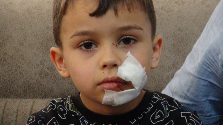 Başıboş köpeğin saldırdığı Yiğit'e 11 dikiş atıldı