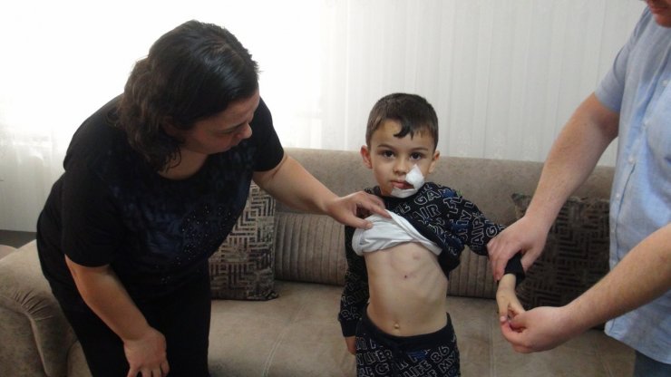 Başıboş köpeğin saldırdığı Yiğit'e 11 dikiş atıldı