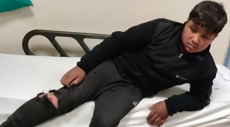 Bahçede oynayan kuzenler köpeklerin saldırısında yaralandı