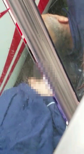 Tramvayın çarptığı genç kız yaralandı