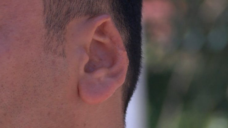 Kavgada ısırılarak koparılan kulağını martı kaptı