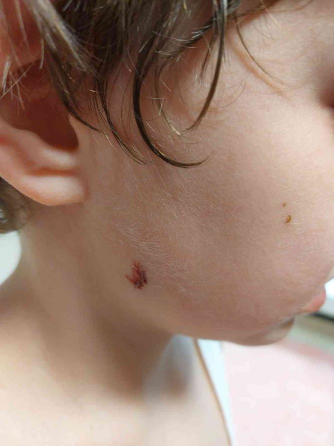 Sahipsiz köpekler 5 yaşındaki çocuğa saldırdı