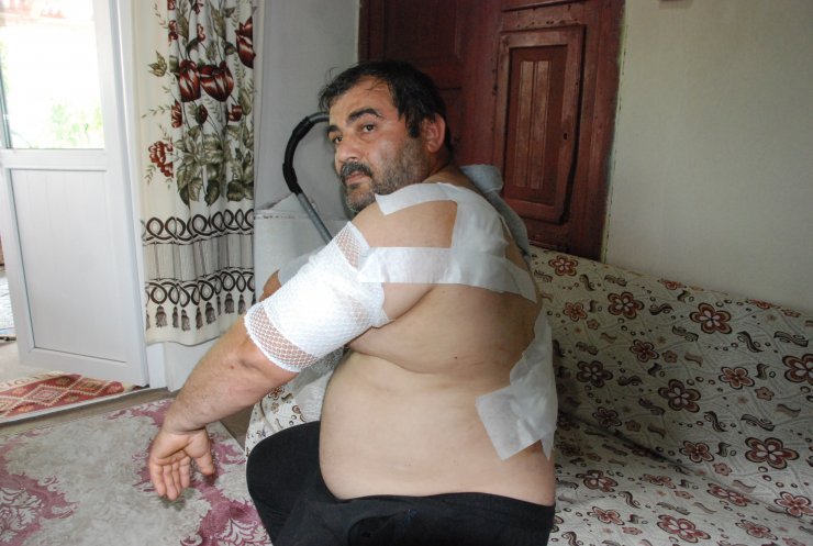 Ayının saldırdığı işçi: Öldüğümü sanıp bıraktı 