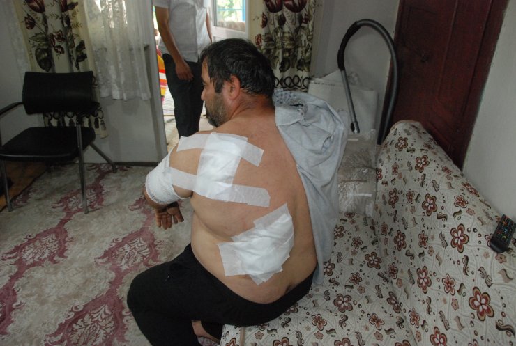 Ayının saldırdığı işçi: Öldüğümü sanıp bıraktı 