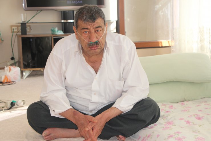 Sigara nedeniyle oksijen makinesine bağımlı kaldı