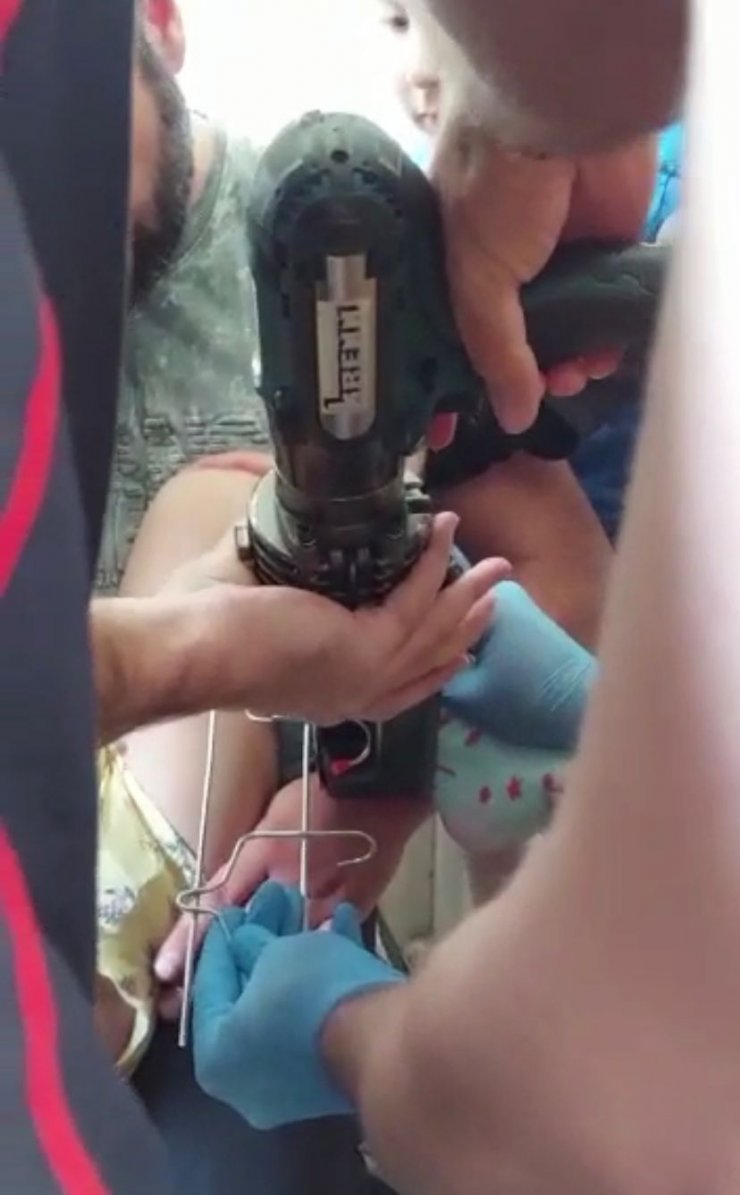 Bacağına saplanan askıyı itfaiye kesti