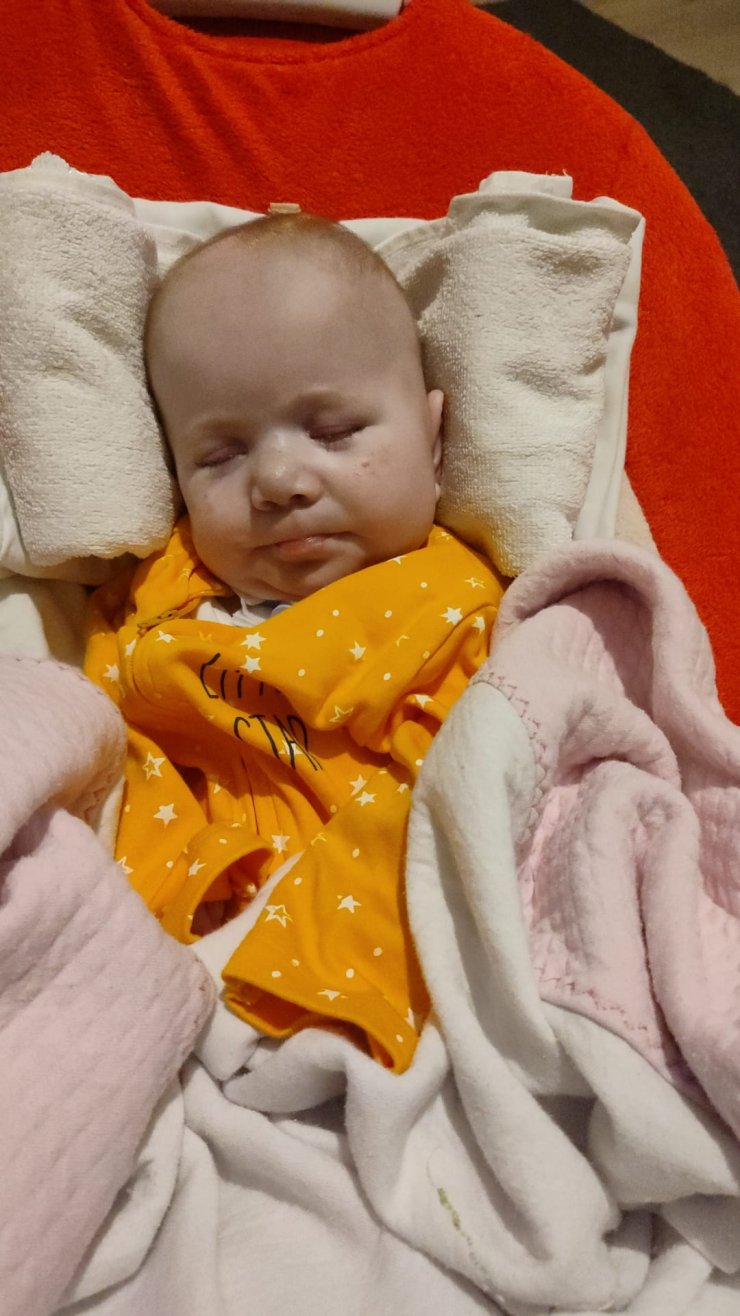 Ölümcül hastalıkla mücadele eden 7,5 aylık Poyraz kurtarılamadı