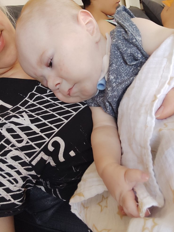 Ölümcül hastalıkla mücadele eden 7,5 aylık Poyraz kurtarılamadı