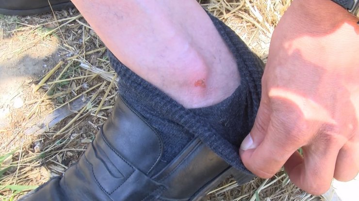 Eski nişanlı dehşeti; otomobiliyle çarptı, yol kesip darbetti 